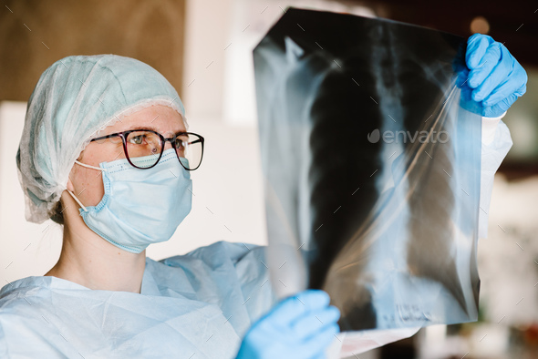 Doctor specialist pulmonary medicine holding radiological, chest x-ray film for medical diagnosi