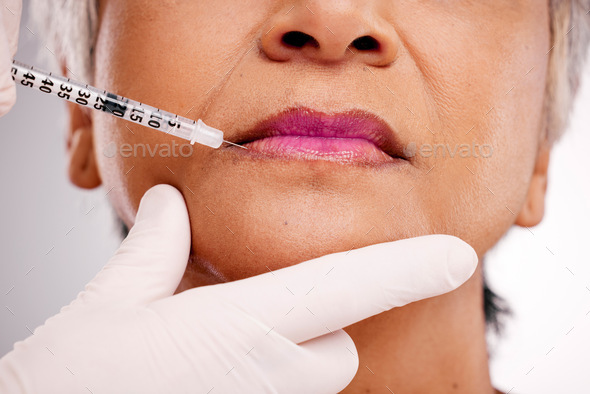Mouth needle, plastic surgery hands and woman with closeup surgeon augmentation, lip filler or sili
