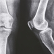 Knee xray. Knee xray. Front and lateral view. Healthcare. Examination - PhotoDune Item for Sale