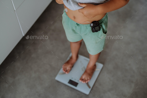 A young boy with diabetes weighing himself on bathroom scale.