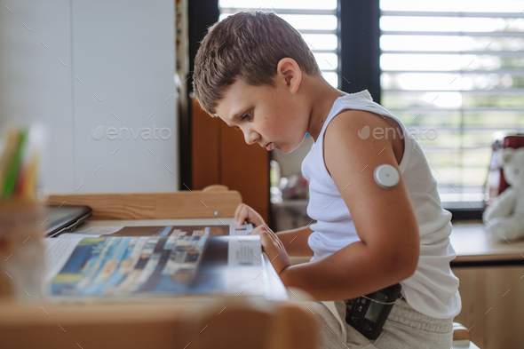The diabetic boy doing homework, while wearing a continuous glucose monitoring sensor on his arm.