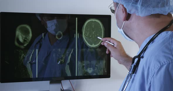 Doctor Reviewing Brain X-rays 09