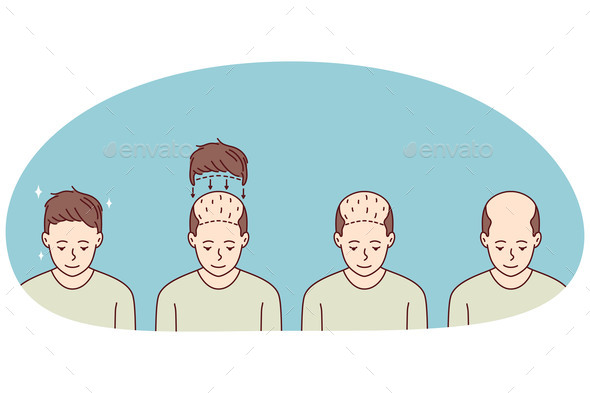 Stages of Man Hair Transplant