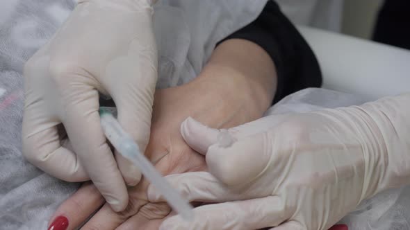 The Cosmetologist Inserts an Injection Into the Palm of the Patient