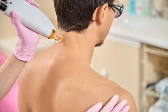 Male at laser hair removal session on back of neck