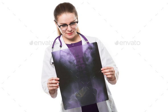 Attractive Young Woman Doctor Holding X Ray Making Diagnosis In White