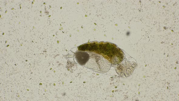 Rotifer Filters Water, and Around It I Swim the Alga Dunaliella Salina, Under a Microscope alt