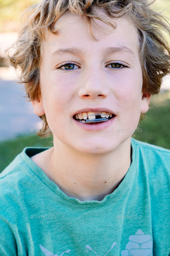 Boy getting an orthodontic appliance to correct jaw misalignment. Stock ...