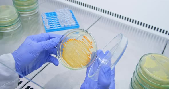Petri dish with bacteria in the hands of a scientist in laboratory. alt