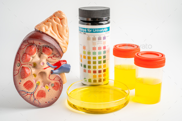 Urinalysis, Kidney model and urine cup with reagent strip pH paper test ...