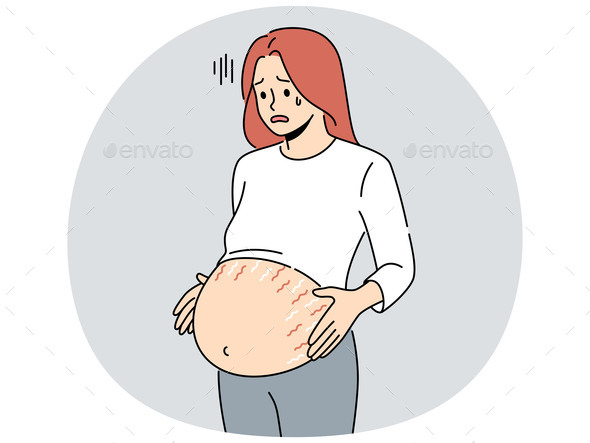 Pregnant Woman with Stretchmarks on Belly