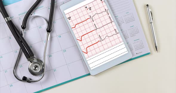Doctor Workplace with a Stethoscope Electrocardiogram Heart Rate Readings alt