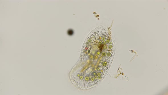 Infusoria Kerona polyporum under a microscope alt