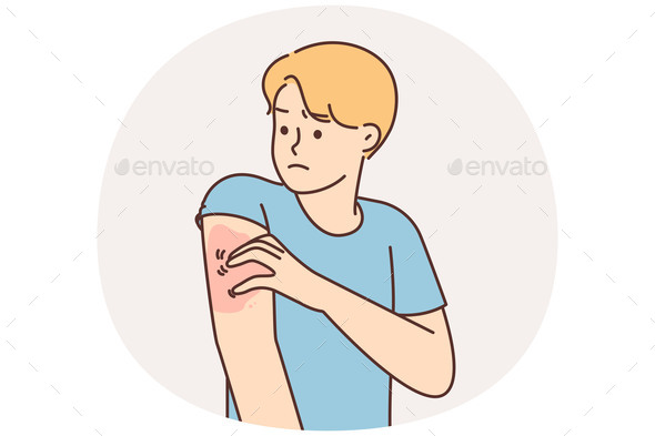 Unhealthy Man Scratching Arm Suffer From Pox