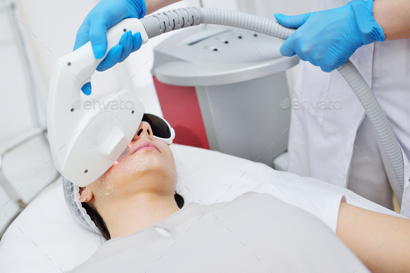 The cosmetologist restores the patient\'s skin with the help of hardware RF -fractional rejuvenation