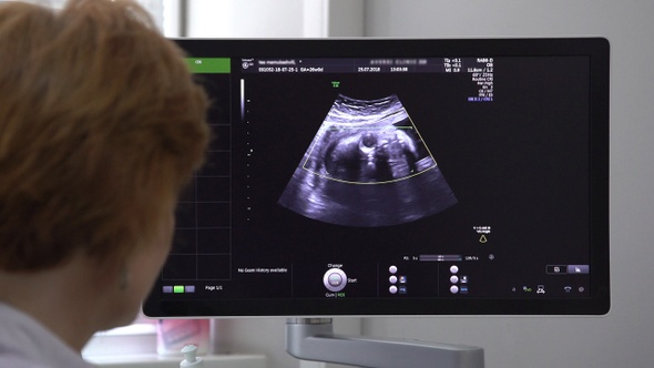 Ultrasound Examination Of Human Embryo