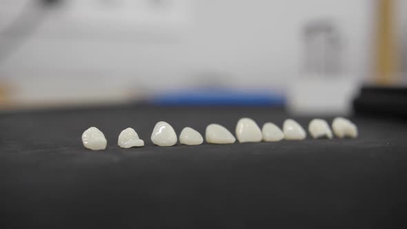 Veneers in Dentistry alt