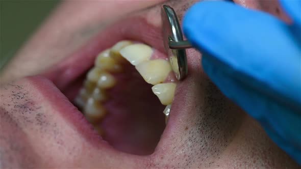 Dentist Examines The Teeth