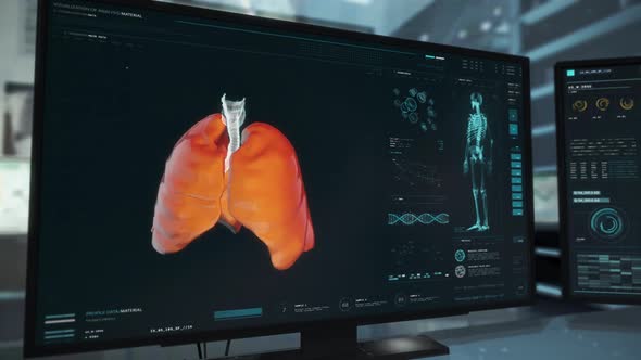 X-ray Monitoring Device Software Interface Scans Infected Patient Lung Organ alt