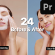 Before and After - Instagram Stories - VideoHive Item for Sale