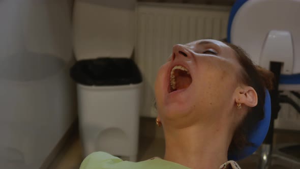 Young Adult Woman Treats Teeth in a Dental Clinic
