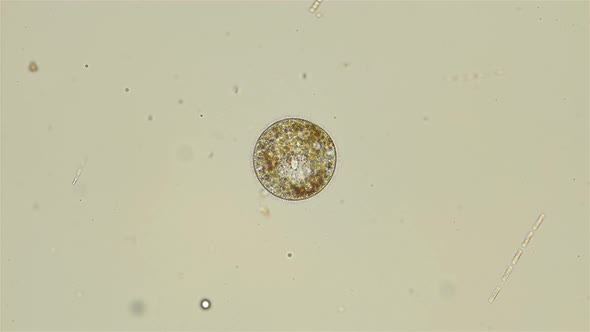 Ciliated infusoria under a microscope, Alveolata. alt