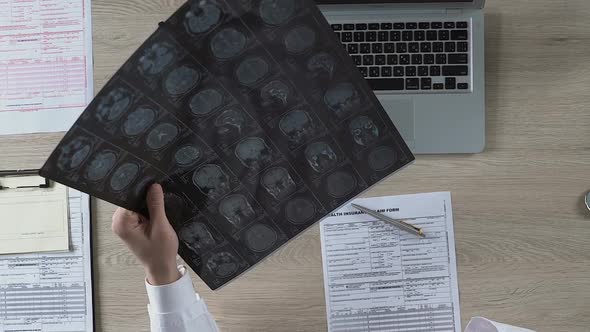 General Practitioner Asking Oncologist to Come and Look at Brain Mri of Patient alt