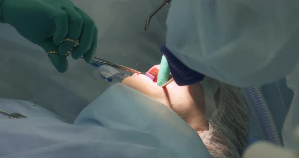 The Surgeon Applies a Suture After Removing Wisdom Teeth to the Patient alt