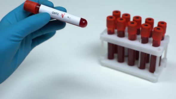 Negative G6PD Test, Doctor Showing Blood Sample, Lab Research, Health Check-Up alt