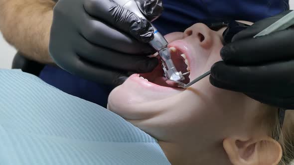 a Children's Dentist Drills Caries in the Tooth of a Little Girl with Her Eyes Protected From the