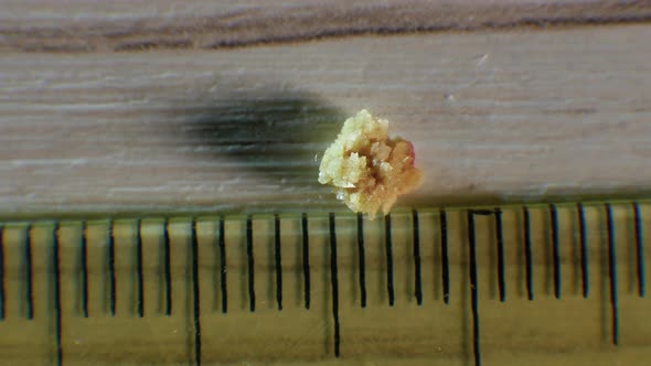 Top View Oxalate Kidney Stone, The Stone Is Removed From The Kidney, Kidney Stone. Natural Stone