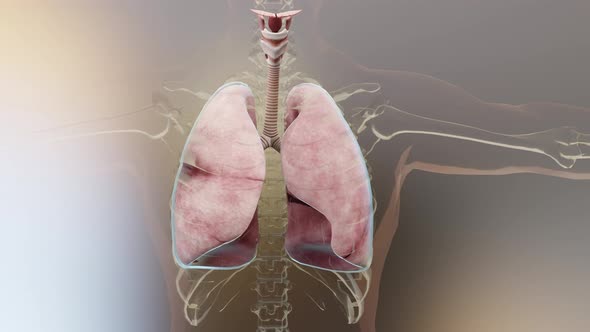 Pneumothorax, Hemothorax and Hemopneumothorax, Normal lung versus ...