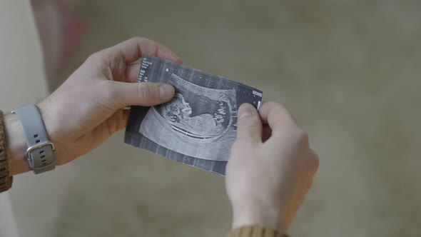 Closeup of Ultrasound Picture in Male Caucasian Hands alt