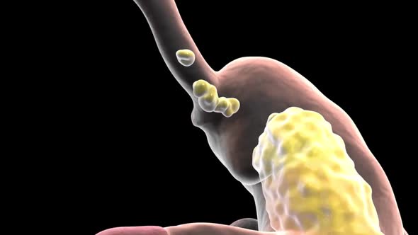 Food moving through the digestive tract alt