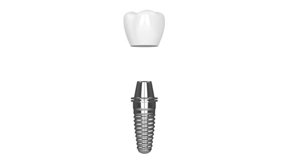 Dental implant installation over white background