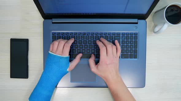 Fiberglass Cast Hand Laptop