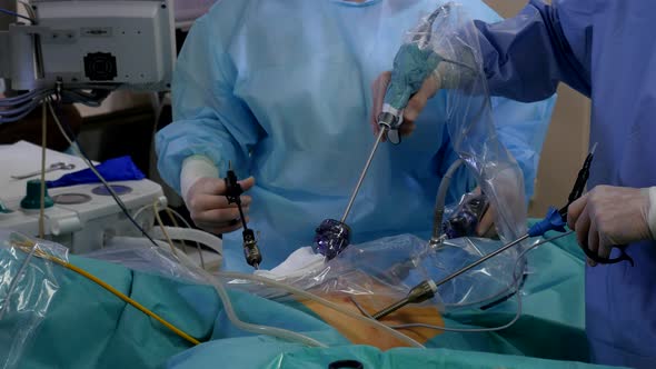 Surgeons Performing Laparoscopic Surgery