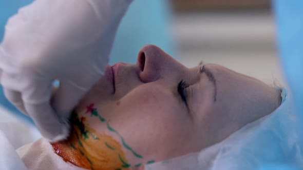 Closeup Picture of Adult Woman Lying on Table in Operating Room with Closed Eyes While Paramedic alt
