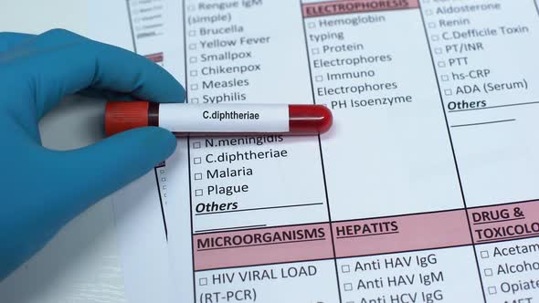 C Diphtheriae, Doctor Checking Disease in Lab Blank Showing Blood Sample in Tube alt
