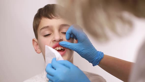 Dentist examines the baby teeth. Painless dental treatment, caries in children alt