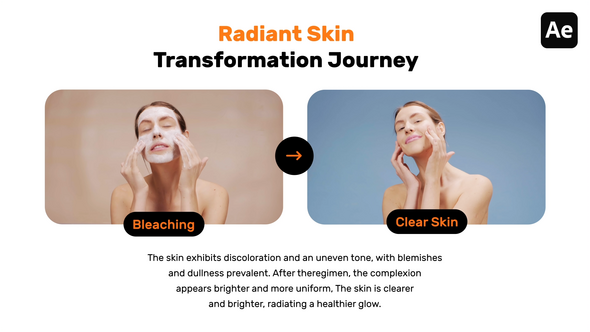 Before After Social Media Videos Video Displays template preview