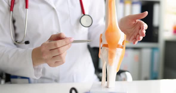 Doctor Shows Anterior and Posterior Cruciate Ligaments and Patella Model of Leg alt