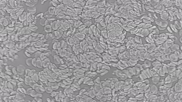 Blood Under the Microscope, the Rapid Movement of Red Blood Cells in the Blood alt