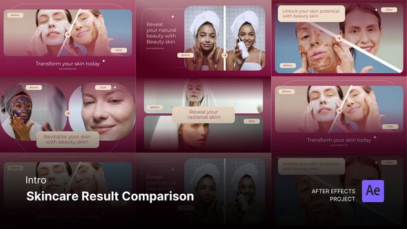 Intro/Opening - Skincare Result Comparison After Effects Project Files Product Promo template preview