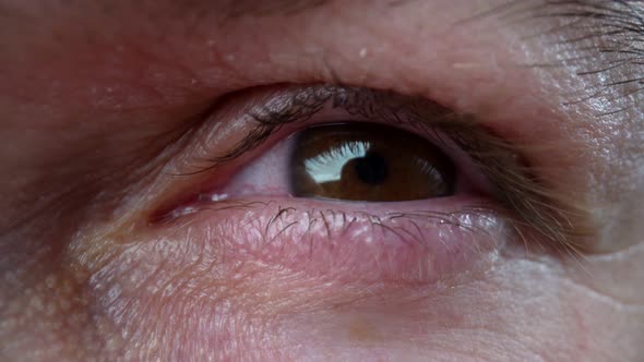 Extreme Closeup Eyes with Red Whites After Insomnia Long Work at the Computer alt