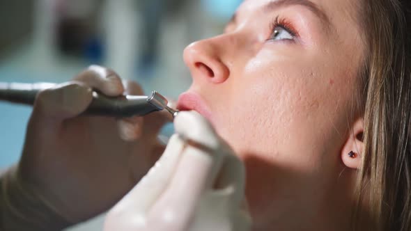 Tooth Polishing in Dental Clinic alt