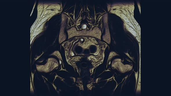 Voluminous Color MRI of the Female Pelvic Organs, Abdominal Cavity, Gastrointestinal Tract alt