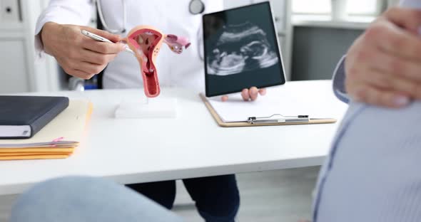 Gynecologist Shows Female Reproductive System Ultrasound Fetus Pregnant Woman alt