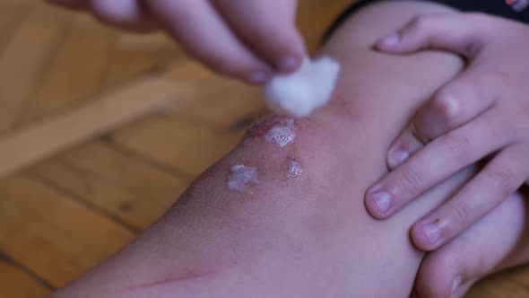 a Teenager Independently Treated an Abrasion on His Knee with an Antiseptic and Cotton Wool