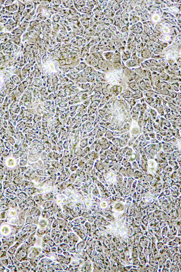 Colon Cancer cells